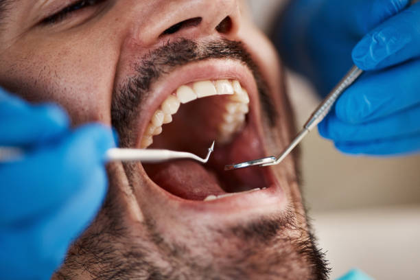 Best Emergency Gum Treatment in Chelsea, OK